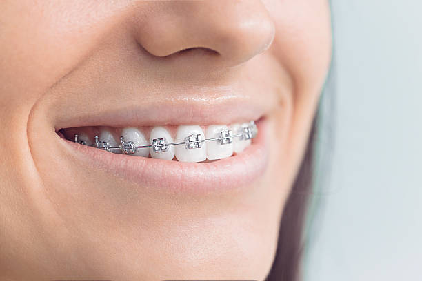 Best Invisalign and Clear Aligners  in Walnut Grove, CA